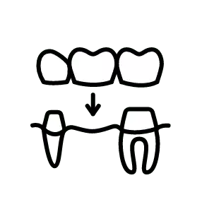 restorative-dentsitry2x 2 dentist near me in Dewsbury