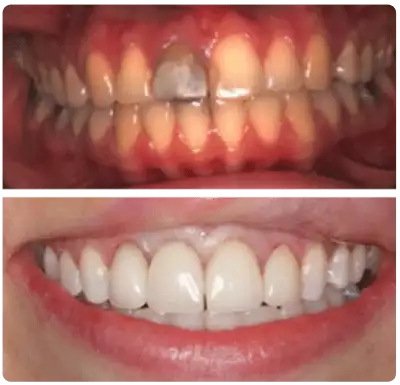 dental implants Wakefield patient results