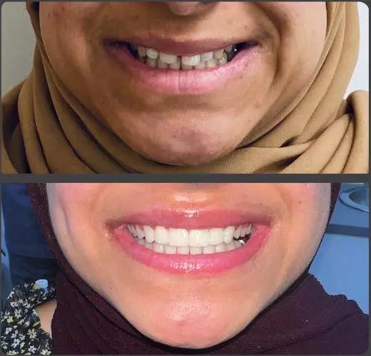 Invisalign Dewsbury